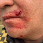 Un conductor agredió a un efectivo de la caminera y quedó detenido