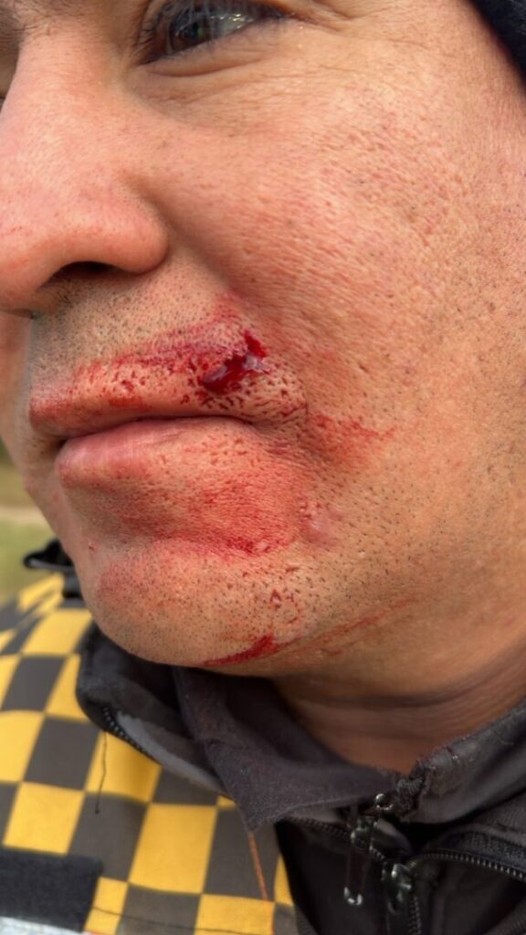 Un conductor agredió a un efectivo de la caminera y quedó detenido