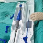 El Nuevo Hospital San Roque realizó una novedosa cirugía cardiológica
